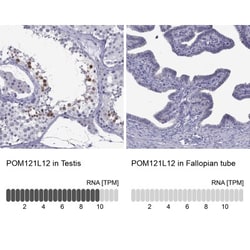 POM121L12 Antibody, Novus Biologicals:Antibodies:Primary Antibodies
